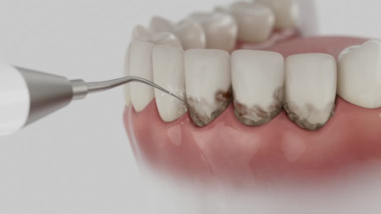 Reliable Dental contractor in Covington, WA by Smile Center Dentistry